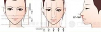 鼻子综合整形 鼻部综合整形