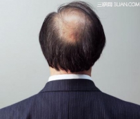 护发怎么预防脱发方法