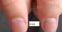 如何从指甲看血气不足