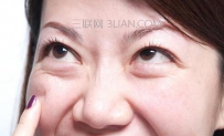 脾虚长眼袋该如何调理